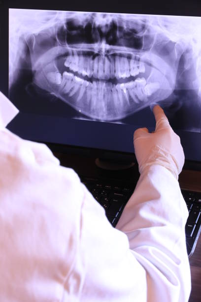 Best Weekend Emergency Dentist in Stro Valley, CA