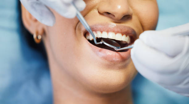 Best Emergency Gum Treatment in Stro Valley, CA